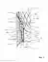 Fig. 02 - HEART VALVE PROSTHESIS WITH OUTER SKIRT