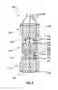 Fig. 09 - Modular valve prosthesis, delivery system, and method of delivering and deploying a modular valve prosthesis