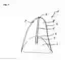 Fig. 02 - METHOD FOR PRODUCING AN ATTACHMENT PIECE OF A COVER DEVICE FOR A BONE DEFECT SITE, AND DEVICE FOR COVERING AND/OR RECONSTRUCTING A BONE DEFECT SITE