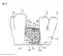 Fig. 10 - METHOD FOR PRODUCING AN ATTACHMENT PIECE OF A COVER DEVICE FOR A BONE DEFECT SITE, AND DEVICE FOR COVERING AND/OR RECONSTRUCTING A BONE DEFECT SITE