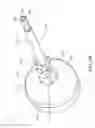 Fig. 06 - Devices, apparatuses, kits, and methods for anchoring a suture to a bone