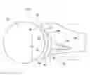 Fig. 01 - PARTIAL JOINT RESURFACING