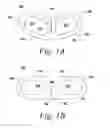 Fig. 02 - Spinal fusion implant