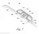 Fig. 08 - Spinal fusion implant