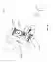 Fig. 28 - Hybrid prosthesis installation systems and methods