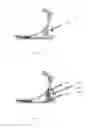 Fig. 07 - RESPONSIVE PROSTHESES