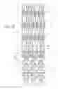 Fig. 03 - Method of treating vascular bifurcations