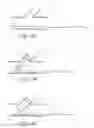 Fig. 32 - Method of treating vascular bifurcations