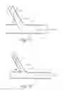 Fig. 37 - Method of treating vascular bifurcations