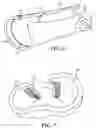 Fig. 06 - WATERPROOF, POLYMERIC BRACE