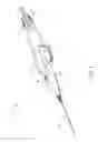 Fig. 02 - Injection device for subretinal delivery of therapeutic agent