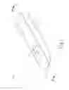 Fig. 03 - Apparatus and method to form entry bleb for subretinal delivery of therapeutic agent