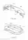 Fig. 28 - Apparatus and method to form entry bleb for subretinal delivery of therapeutic agent