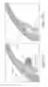 Fig. 40 - METHODS AND DEVICES FOR INCREASING AQUEOUS HUMOR OUTFLOW
