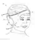 Fig. 01 - SOUND MUFFLING HEADWEAR
