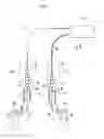 Fig. 06 - Movement assistance device