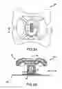 Fig. 08 - Enhanced guided active compression decompression cardiopulmonary resuscitation systems and methods