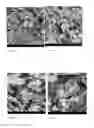 Fig. 06 - Polysaccharide delivery particle