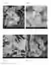 Fig. 07 - Polysaccharide delivery particle