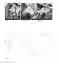 Fig. 08 - Polysaccharide delivery particle