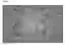 Fig. 04 - Foamable vehicles and pharmaceutical compositions comprising aprotic polar solvents and uses thereof