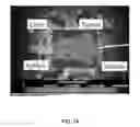 Fig. 09 - COMPOSITIONS AND METHODS FOR INDUCING NANOPARTICLE-MEDIATED MICROVASCULAR EMBOLIZATION OF TUMORS
