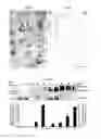 Fig. 02 - Methods of preventing neurodegeneration of association cortex in a mammal