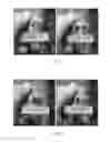 Fig. 07 - Injectable anticancer composition for local administration containing suspension of quinine salt