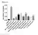 Fig. 19 - Vascular calcification