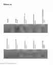 Fig. 20 - Vascular calcification