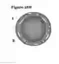 Fig. 24 - Vascular calcification