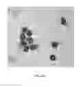 Fig. 35 - Microsphere-based delivery and ex vivo manipulation of dendritic cells for autoimmune therapies