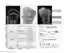 Fig. 02 - Factors and cells that provide for induction of bone, bone marrow, and cartilage