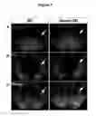 Fig. 09 - METHODS FOR PRODUCING DOPAMINERGIC NEURONS AND USES THEREOF