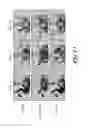 Fig. 12 - Compositions and methods for treating and preventing tissue injury and disease