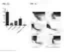 Fig. 06 - COMPOSITIONS CONTAINING A SPIRANTHES SINENSIS EXTRACT AND PHARMACEUTICAL APPLICATIONS THEREOF