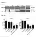 Fig. 07 - COMPOSITIONS CONTAINING A SPIRANTHES SINENSIS EXTRACT AND PHARMACEUTICAL APPLICATIONS THEREOF