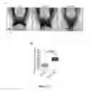 Fig. 30 - Modulation and detection of a neuronal alternative splicing regulatory network for treatment and diagnosis of neurological disorders