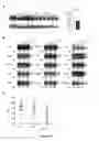 Fig. 37 - Modulation and detection of a neuronal alternative splicing regulatory network for treatment and diagnosis of neurological disorders