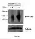 Fig. 55 - Modulation and detection of a neuronal alternative splicing regulatory network for treatment and diagnosis of neurological disorders