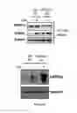 Fig. 56 - Modulation and detection of a neuronal alternative splicing regulatory network for treatment and diagnosis of neurological disorders
