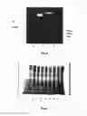 Fig. 04 - NEUREGULIN BASED METHODS AND COMPOSITIONS FOR TREATING CARDIOVASCULAR DISEASES