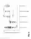 Fig. 07 - Treating seizure with recombinant alkaline phosphatase