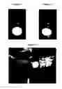 Fig. 05 - Pharmaceutical composition comprising plasminogen and uses thereof