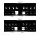 Fig. 07 - Pharmaceutical composition comprising plasminogen and uses thereof