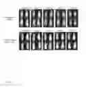 Fig. 06 - CS1 targeted chimeric antigen receptor-modified T cells