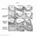 Fig. 20 - Thromboresistant-anticoagulant extracellular matrix