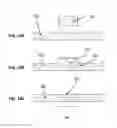 Fig. 09 - Immobilizer preform, immobilizer device, and method of forming the same