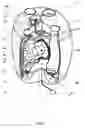 Fig. 05 - INTEGRAL ARTIFICIAL HEART DEVICE