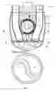 Fig. 08 - INTEGRAL ARTIFICIAL HEART DEVICE